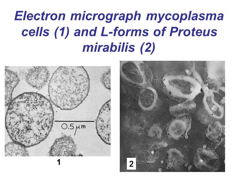 Electron micrograph mycoplasma cells (1) and L-forms of Proteus mirabilis (2) 1 2